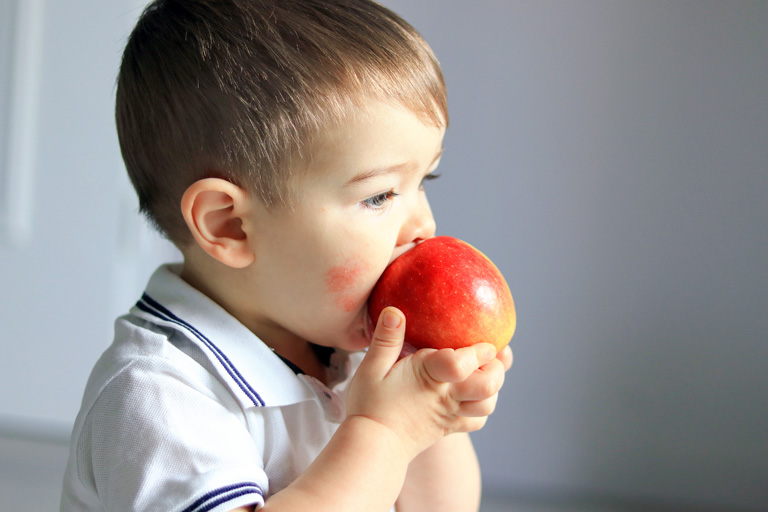 Bei Neurodermitis beim Kleinkind kann die Ernährung eine Rolle als Schubauslöser spielen.